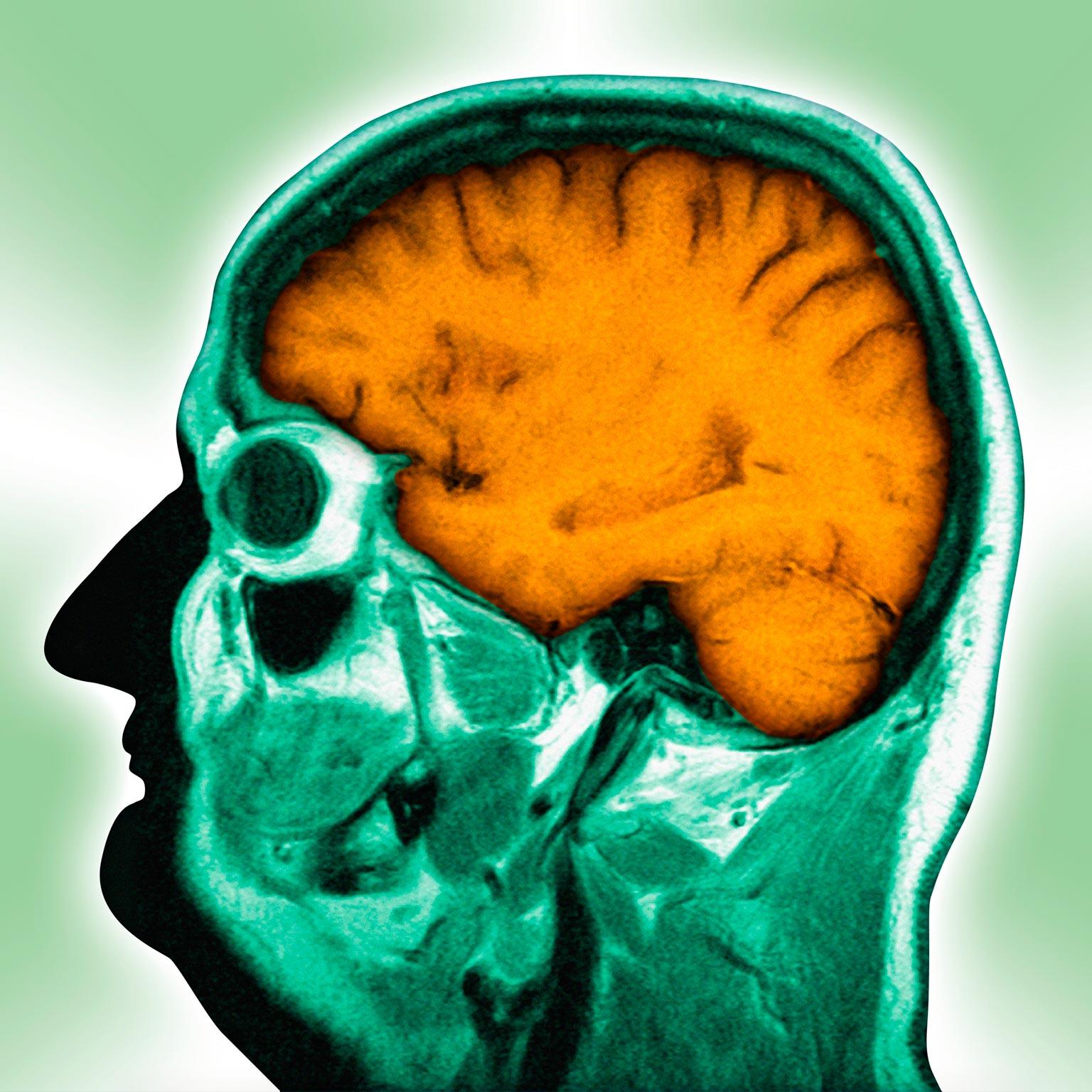 Quarterly-2015_web_neuromyths_2_85757919_1536_Original