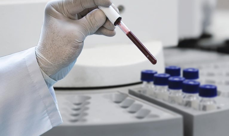 COVID-19 and in vitro diagnostics: New market forces at play