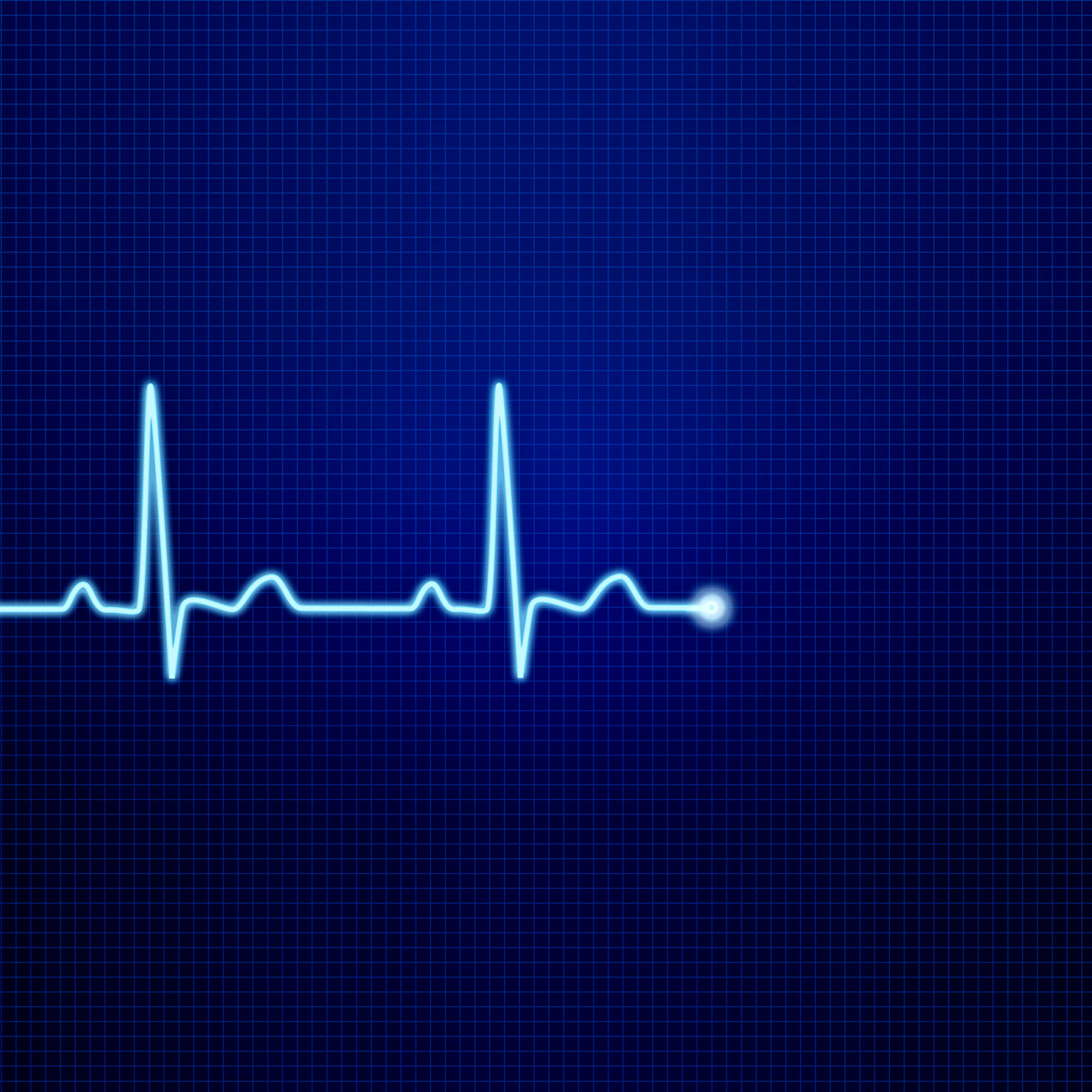  Image of an EKG pulse waveform.